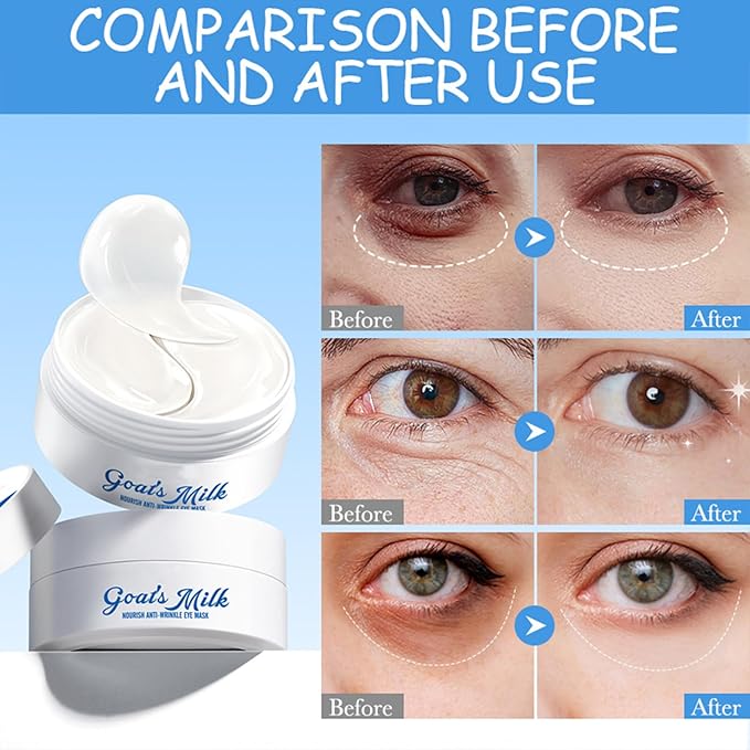 Under Eye Patches for Dark Circles & Puffy Eyes - 60 Pairs Hydrating Eye Mask with Hyaluronic Acid,Goats Milk & Hydrolyzed Elastin- Vegan, Cruelty-Free