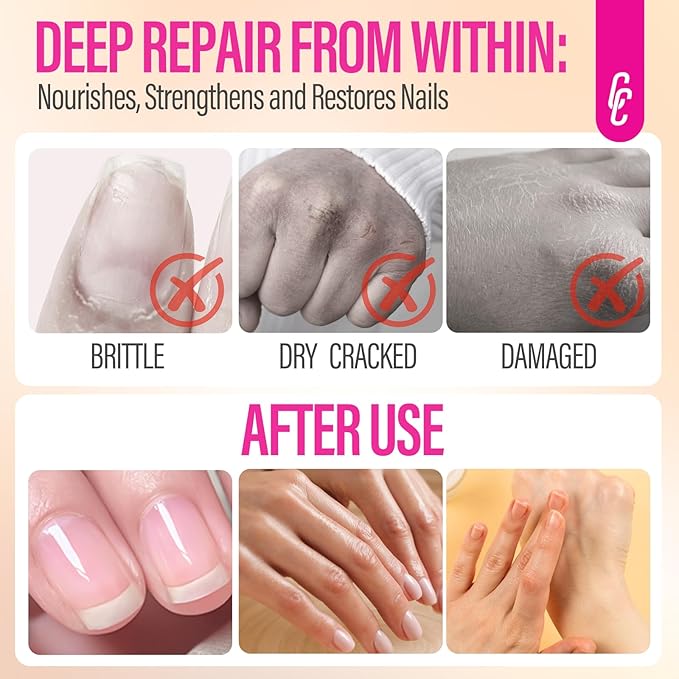 CHUCHU Nail Growth and Strengthening Serum: Natural Plant Repair Serum with Honey Milk Scent - Nail Cuticle Care for Women Men Home Salon Gift