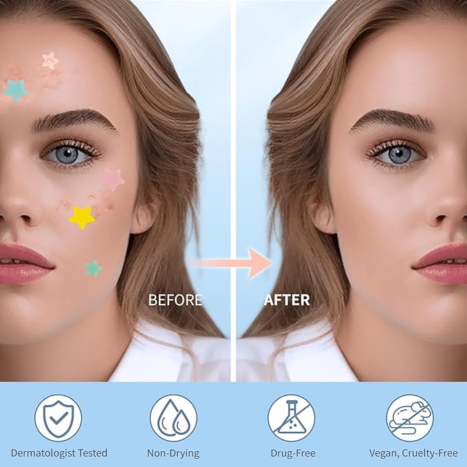 Pimple Patches for Face, Colorful Hydrocolloid Acne Patches, Cute Star Zit Covers for Face, Spot Stickers with Tea Tree, Salicylic Acid & Cica Oil| 4 Sizes (8mm, 10mm, 12mm & 14mm) |357 Count