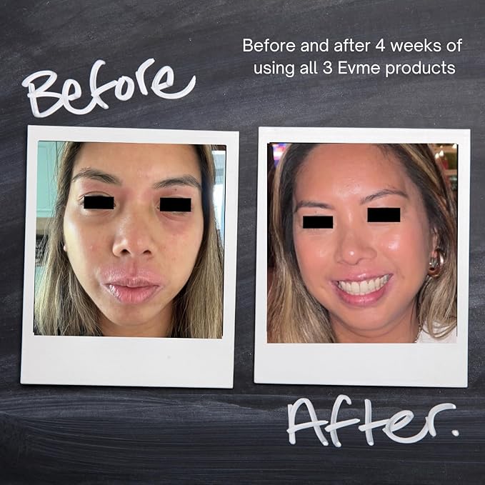 Evme Skincare Kit – Gentle Cleanser, Hydrating Serum & Night Cream – Nourishing for Sensitive Skin, Aiming for Sans-allergenic, Dermatologist-Tested, Fragrance-Free, Made in USA