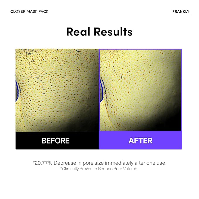 FRANKLY Closer Pore Minimizing Mask – Korean Semi-Gel Face Sheet Mask for Pore Care, Hydration & Firming | Korean Skin Care with Collagen, Triple Hyaluronic Acids & Peptides | 0.74 fl oz, 1pc