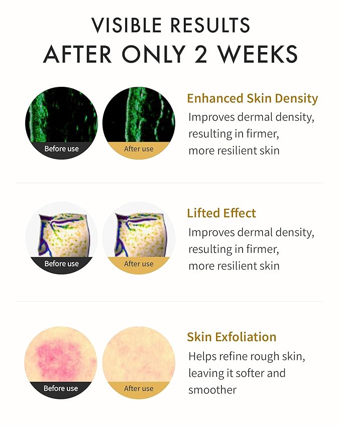 REJURAN Dual Effect Ampoule, DOT™ DUAL c-PDRN® - Rejuvenating Face Serum for Radient Glass Skin, Wrinkle and Fine Line Treatment, Firming, and Deep Hydration, Korean Skincare (1.01 fl oz)