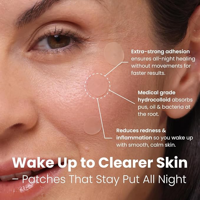 Eliré Night Time Pimple Patch – Extra Strength Hydrocolloid Stickers for Overnight Pimple Healing – Absorbs Pus & Protects Skin – Dermatologist-Tested & Non-Drying