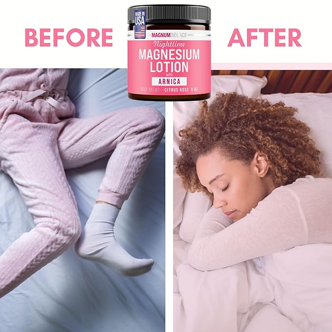 Nighttime Magnesium Lotion with Arnica – Soothing Relief & Relaxation, Highly Concentrated Magnesium for Muscles & Joints – Apply to Legs or Feet Before Bed – Skin-Friendly
