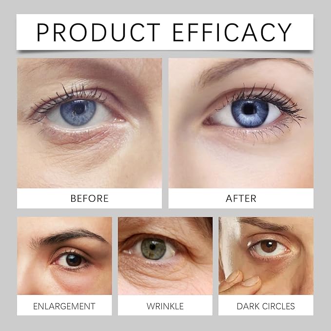 Lumibalm Erases Eye Bags within Minutes, Lumibalm for Under Eye Bags Lumibalm Eye Serum Lumibalm Stick for Under Eye Bags Turmeric Retinol Anti Aging Eye Cream Stick Reduce Fine Lines (2)