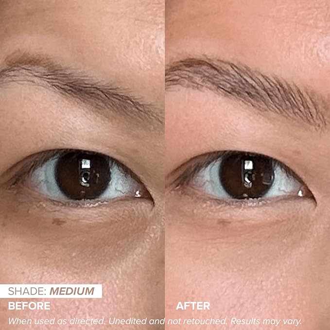 DRMTLGY Dark Circles Bundle - Medium: Luminous Eye Corrector SPF 41 & HPR Eye Cream