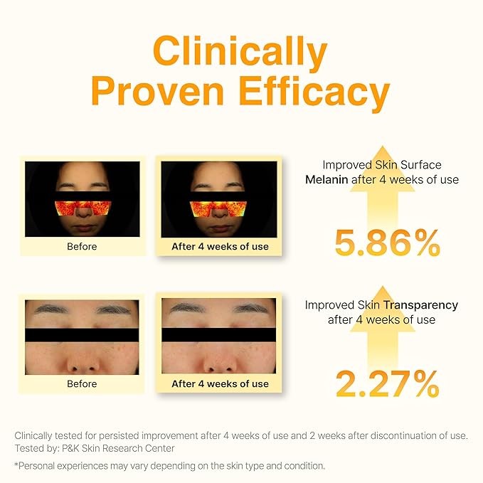 Face Republic Vitamin C 25 Concentrated Ampoule | 25% Ascorbic Acid, Glutathione, Antioxidants | No Irritation, Improve Skin Tone | Radiant Skin