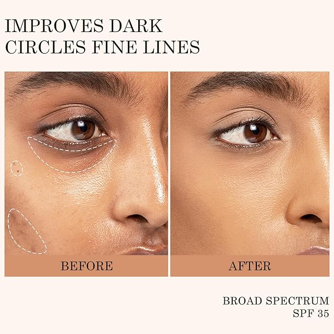 KYDA Mineral Sunscreen Eye Cream, SPF 35, 3-in-1 Under Eye Cream for Dark Circle and Fine Lines