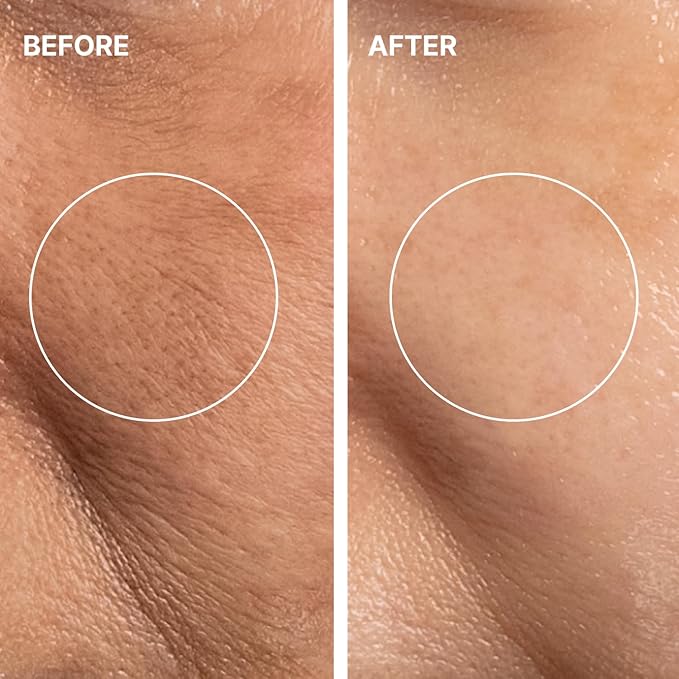 THOME Glow Sealer Mask Refill Set | 6 Sheets of Ultra-high Hydration for Chemical G-Peel at home