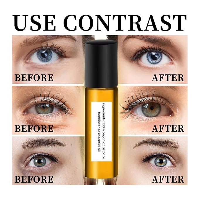 Rollerball Castor Oil And Frankincense, 10 ML Castor Oil And Frankincense Eye Roller, Castor Oil Frankincense Rollerball Under Eye, Castor Oil Roller Ball (3pcs)