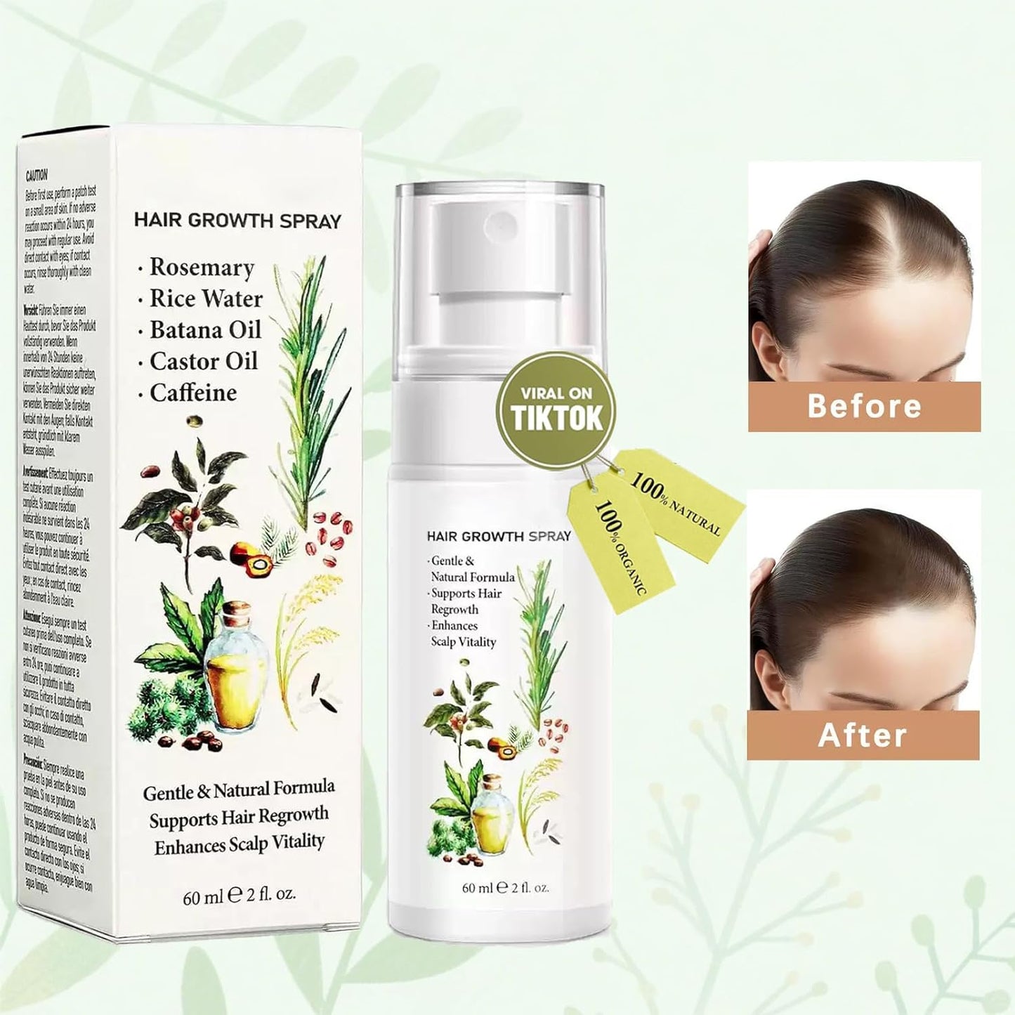 Natural Hair Growth Oil Spray:Rosemary Castor Batana Oil & Rice Water Lotion for Hair Growth ，Promotes Fuller Follicles for Women & Men – All Hair Type