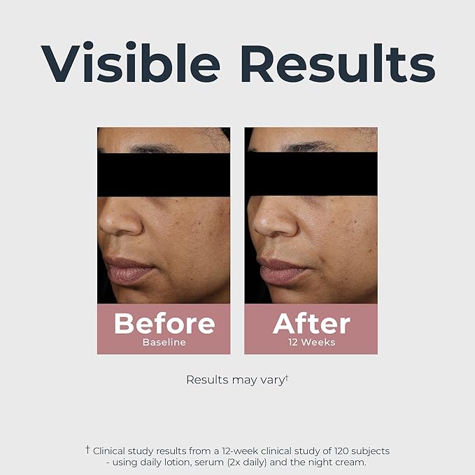 Eucerin Radiant Tone Night Cream, Dark Spot Corrector for Face with Thiamidol, Helps Visibly Reduce the Look of Persistent Dark Spots, 1.7 Oz Bottle