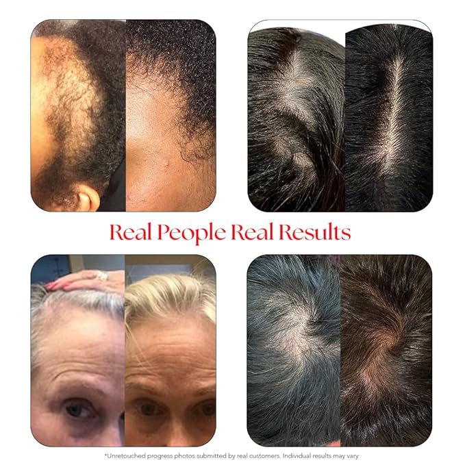 HAIRtamin Scalp Serum | Visibly Thicker, Nourished Hair and Healthy Scalp Treatment (Two Pack)