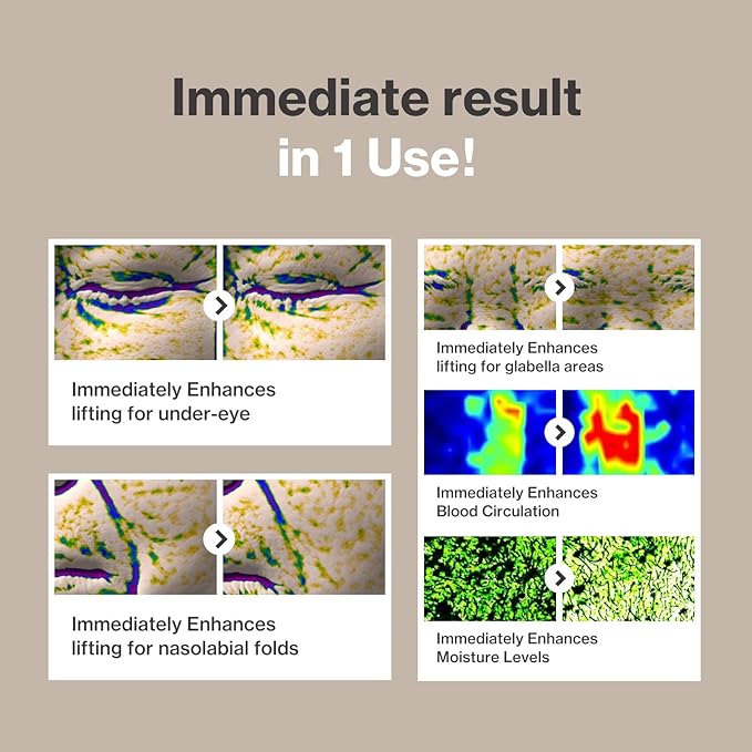 Dermastic Gold Fit Mask | Rejuvenating Facial Masks | Hydrating, Toning & Firming Facial Mask | Helps Enhance Skin Elasticity | Made in Korea - 4 Packs