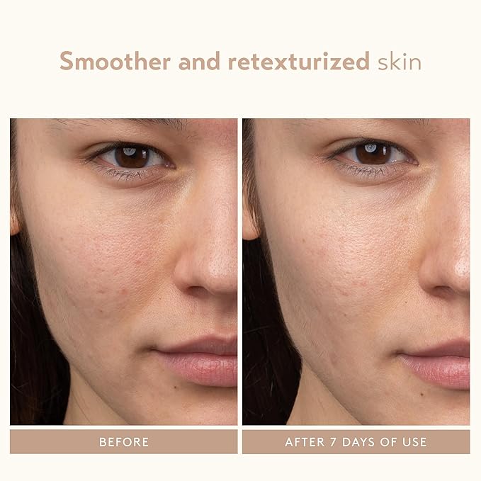 SHANI DARDEN SKIN CARE Lactic Acid Face Serum Travel Size, Active Night Serum to Help with the Look of Radiant and Smooth Skin, Gentle But Powerful Face Exfoliator, 0.34 fl oz