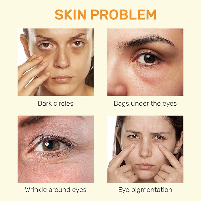 Vitamin C Eye Cream For Dark Circles, Under Eye Cream Anti Wrinkles For Reduce Puffiness And Bags Fine Lines, Wrinkles, Hydrating Eye Lifting Skin Care Anti Aging Eye Cream(0.7 FL.Oz)