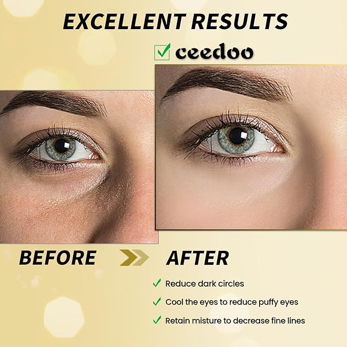 Under Eye Patches - 24 Pairs Gold Under Eye Mask for Puffy Eyes, Dark Circles, Eye Bags, Wrinkles, Collagen Eye Gels with Rejuvenating Treatment, Gifts for Women