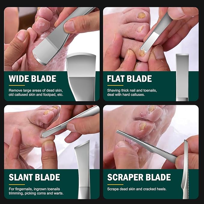 FVION Professional Pedicure Knife Set, 4PCS Ingrown Toenail Removal Blades Kit, Stainless Steel Callus Shaver Foot Blades - Silver