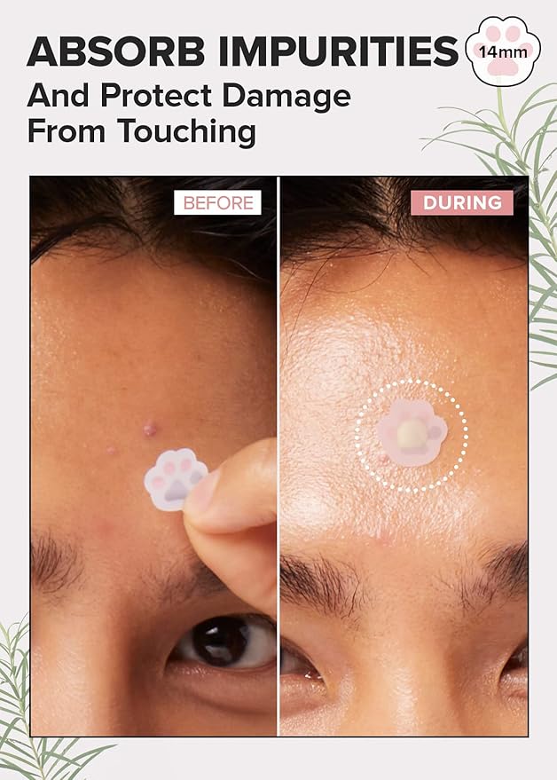 I DEW CARE Facial Skin Care Sets - Starlit Kitten & Happy Paws & Headband | Eye Patch, Cute Pimple Patches, Glass Skin, Facial Treatment, Hydrating, Blemish Treatment for Face, Mother's Day