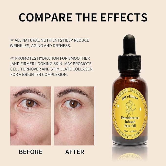 Frankincense Resin Oil For Face，Frankincense Resin Infused Organic Black Seed & Jojoba Oils,Natural skin Care moisturizing, Facial Anti-Aging Moisturizing skin Serum (2)