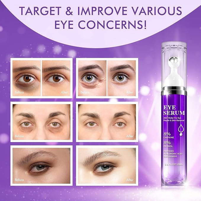 Eye Serum for Dark Circles and Puffiness, Under Eye Cream Anti Aging for Puffiness and Bags with 360° Eye Roller Massage Ball, Eye Serum with 8% Caffeine 8% Retinol for Women & Men