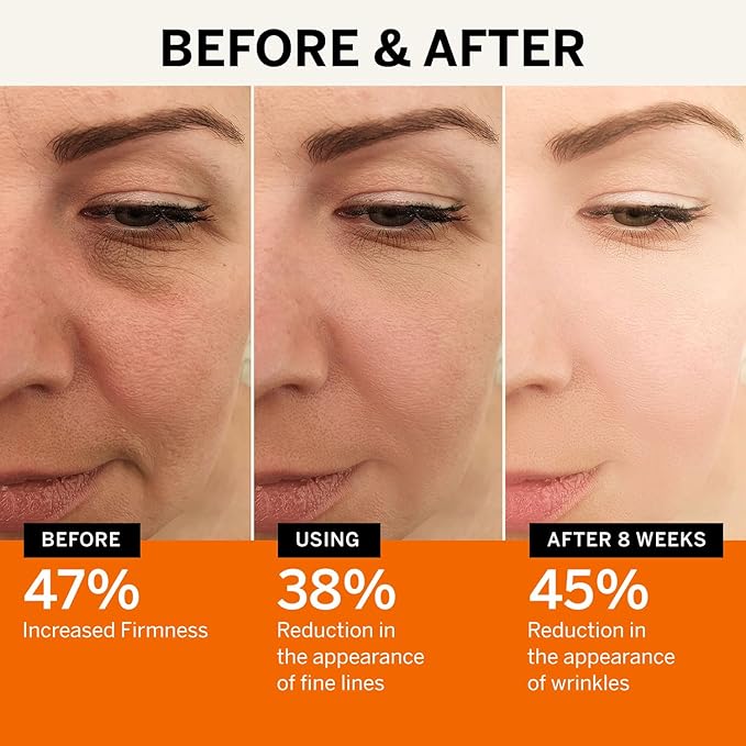 Vitamin C Face Serum: Anti Aging Facial Super Vit C Serum with Ferulic Acid Pure L-Ascorbic Acid, Vitamin E and Hyaluronic Acid for Dark Spots - 1 Fl Oz