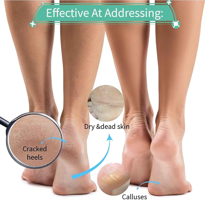 Exfoliating Foot Peel Mask for Dry, Cracked Heels - Moisturizing Foot Mask for Dead Skin & Callus Removal, Lavender Scent, 2 Pack - Foot Spa Treatment for Men & Women