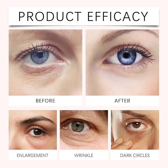 PDRN Pink Peptide Eye Serum Cream, Hydrating & Firming Eye Cream for Dark Circles, Anti-Aging Treatment Reduces Fine Lines, Uneven Skin Tone, Soothing Pink Moisturizer with Peptides, 1.01fl.oz (1)