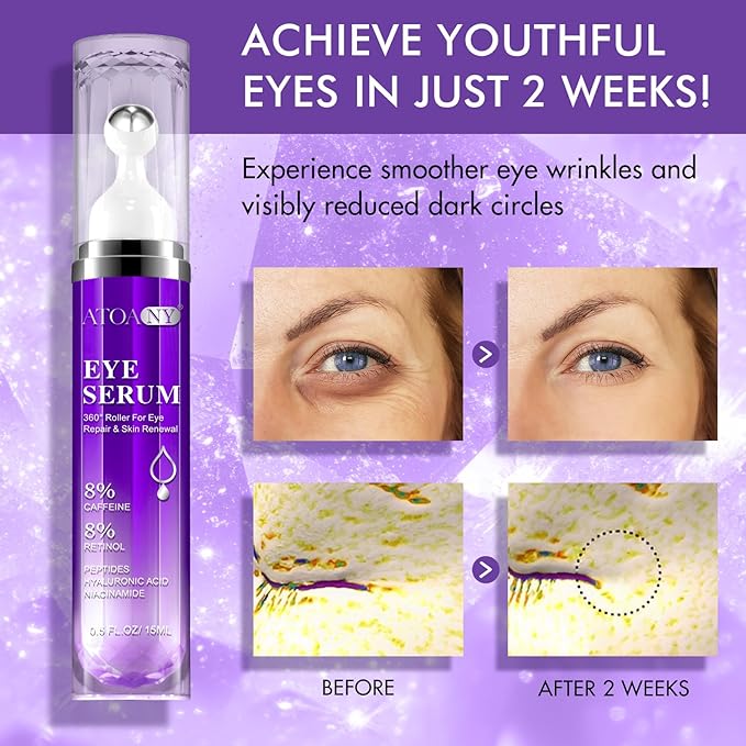 Eye Treatment Serum - 8% Caffeine & Retinol, Hyaluronic Acid, Niacinamide, Peptides - Cream for Dark Circles, Puffy Eyes, Fine Lines - 360° Eye Roller Massage Ball Included, 0.5 fl. oz