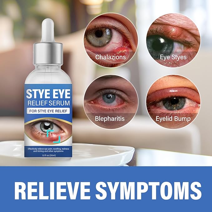 ITECFREELY Stye Eye Treatment, Natural Stye Eye Relief Drops Serum for Styes Chalazion and Blepharitis, Fast Chalazion Remover for Restore Healthier Skin(1 Fl.oz)
