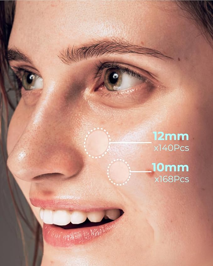 Pimple Patches for Face Acne: Invisible 0.1mm Ultra-Thin Hydrocolloid Zit Stickers with Tea Tree Oil - 308 Dots, 2 Sizes (Whiteheads/Sensitive Skin)