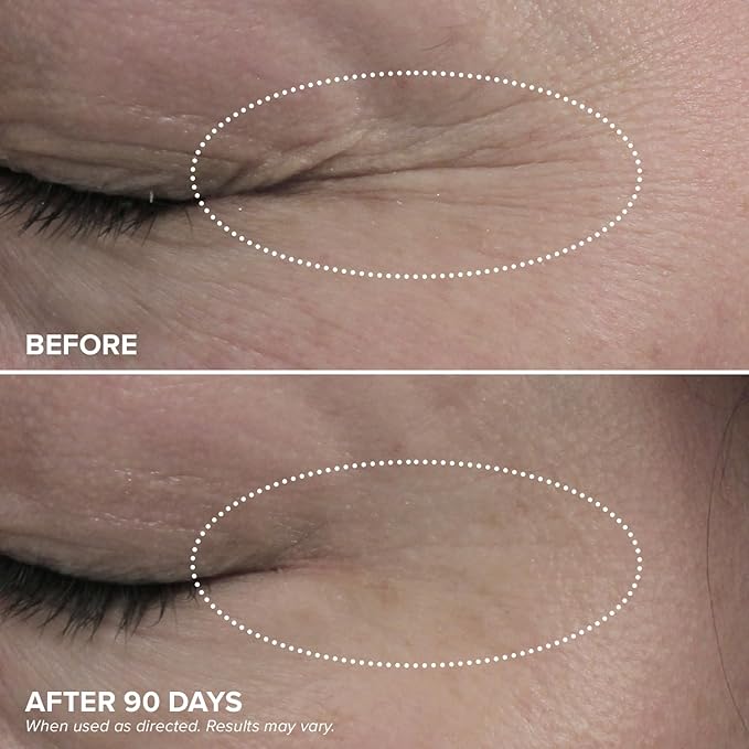 DRMTLGY Bright Eyes Set: HPR Eye Cream & Brightening Eye Masks - Target Dark Circles, Puffiness, Wrinkles, and Bags Under Eyes