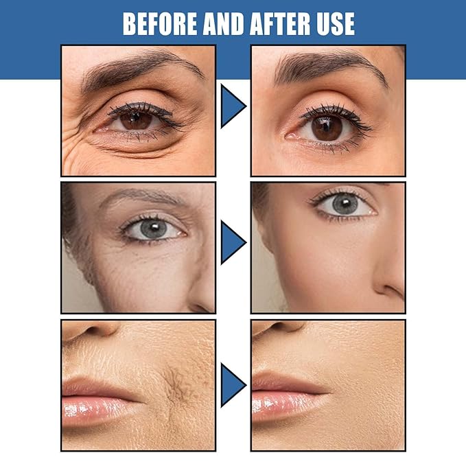 Anti-Aging Face Cream 5 Seconds Instant Retinol Anti-Wrinkle Cream 30g Wrinkle Removal Cream Skin Firming Lifting Moisturizing Facial Cream Remove Fine Line Skin Care,1Pack