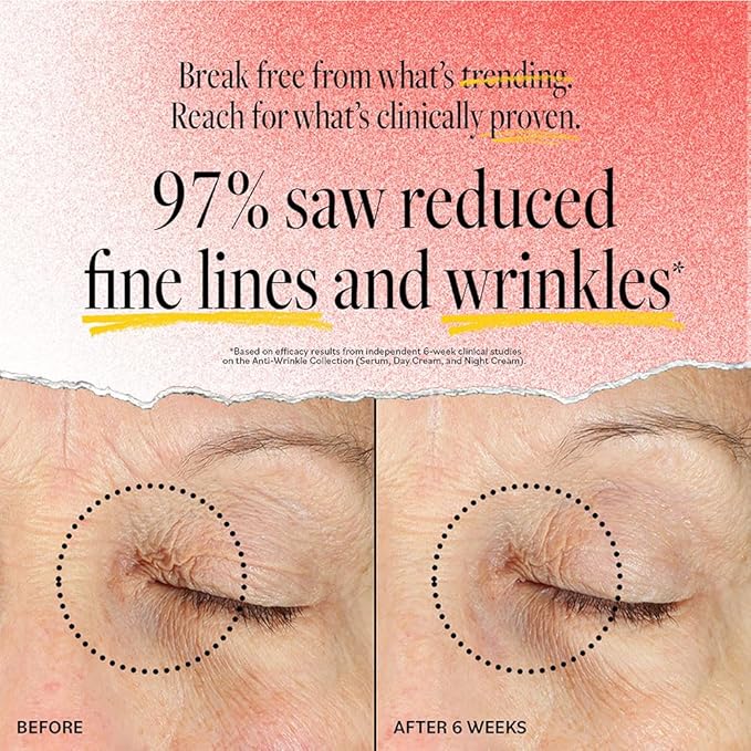 DERMA E Face Serum, Anti Aging Regenerative Retinol Serum for Face, 1 Fl Oz, Vitamin A, Bakuchiol, Glycolic Acid, Green Tea Extract, Helps Reduce Appearance of Fine Lines and Wrinkles