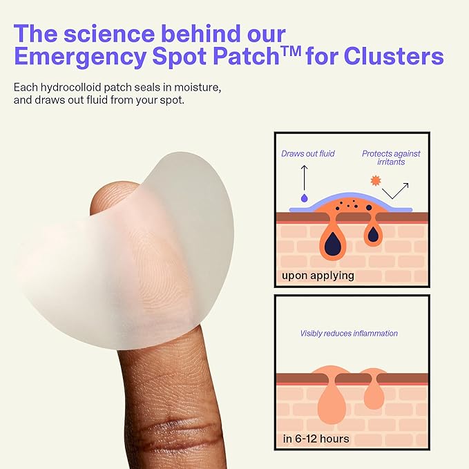 Curology Emergency Spot Pimple Patch Clusters for Breakouts, Large, Fast Acting, 14 Count