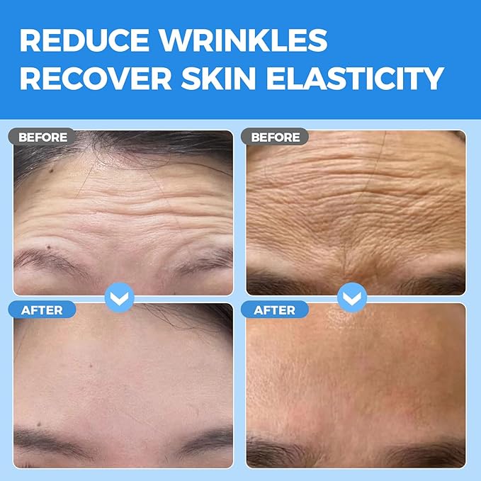 Collagen Forehead Wrinkle Patches Overnight 7pcs, Anti-Wrinkle Facial Patches for Face and Forehead Fine Lines & Frown Lines for Youthful, Firmer, and Smoother Appearance