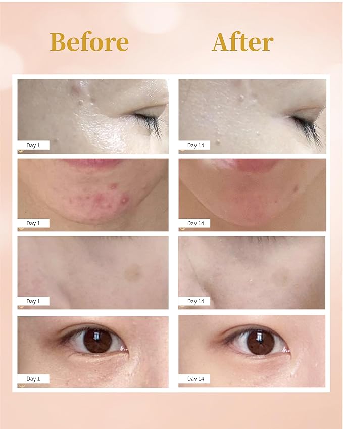 Hydrogen Rich Water Facial Sprayer Nano Mister Portable Face Deep Moisturizing | SPE PEM Technology for Face Hydrating Antioxidant Skin Care Daily Makeup 1400 ppb- Upgraded