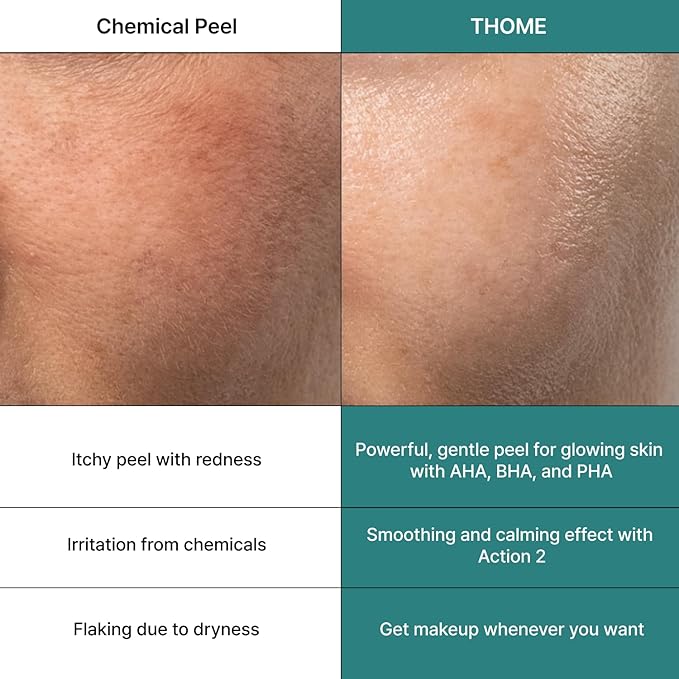 THOME G-Peel Program (12 Sheets) | 4-Step Gentle Peeling for All Skin Types, Sensitive & Dry Skin | Perfect Routine to address fine wrinkles, lines, and hyperpigmentation