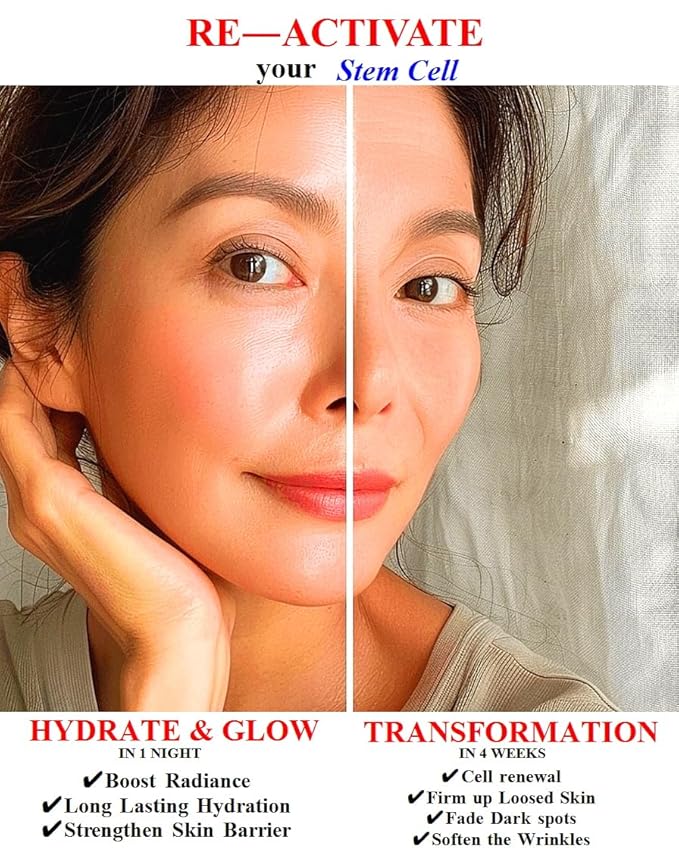 Exceptional Regenerating Serum: Lifts, Volumizes, and Revitalizes with SCM, 5% Volufiline, T1 Collagen, and PHA (30ml, 1oz)