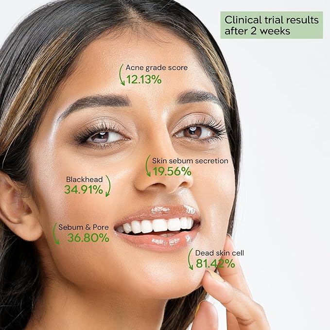 tHermoCEUTICAL DeAC Aciderm Solution - Acne Skin Care, Sebum & Dead Skin Cells Control, Pore Reduction, Acne Grade Down, Skin Trouble Treatment, Fast Absorbing 0.5 fl.oz