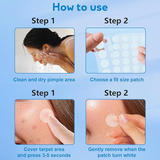 Pimple Patches for Face, 4 Size 360 Counts Acne Patches, Hydrocolloid Patches for Covering Zits and Blemishes, Spot Stickers with Salicylic Acid, Tea Tree Oil & Centella