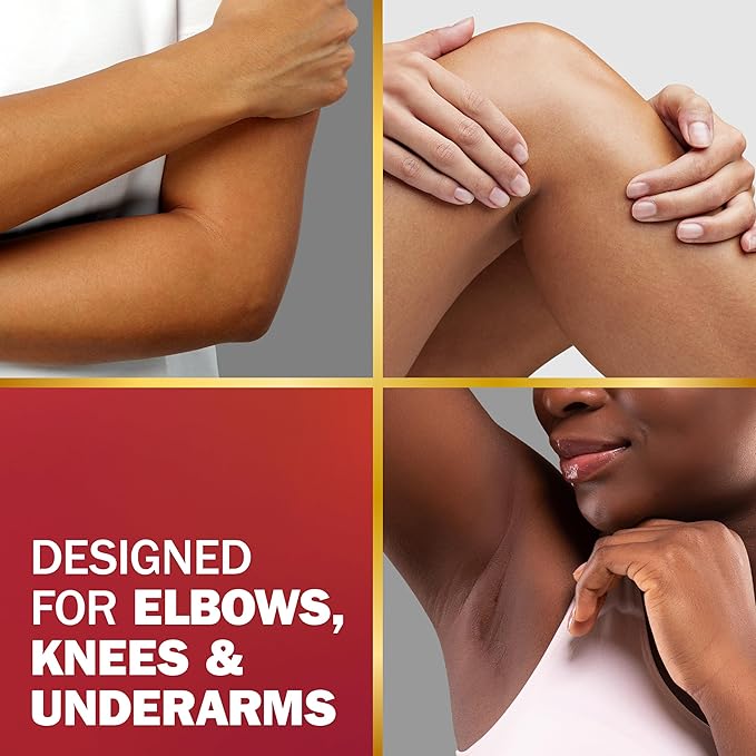 Olay Treatment Cream Intensive Tone Correcting for Elbows Knees & Underarms with Niacinamide, Vitamin B3 Complex, Deeply Hydrates, Evened Skin Tone, 1.7 fl oz