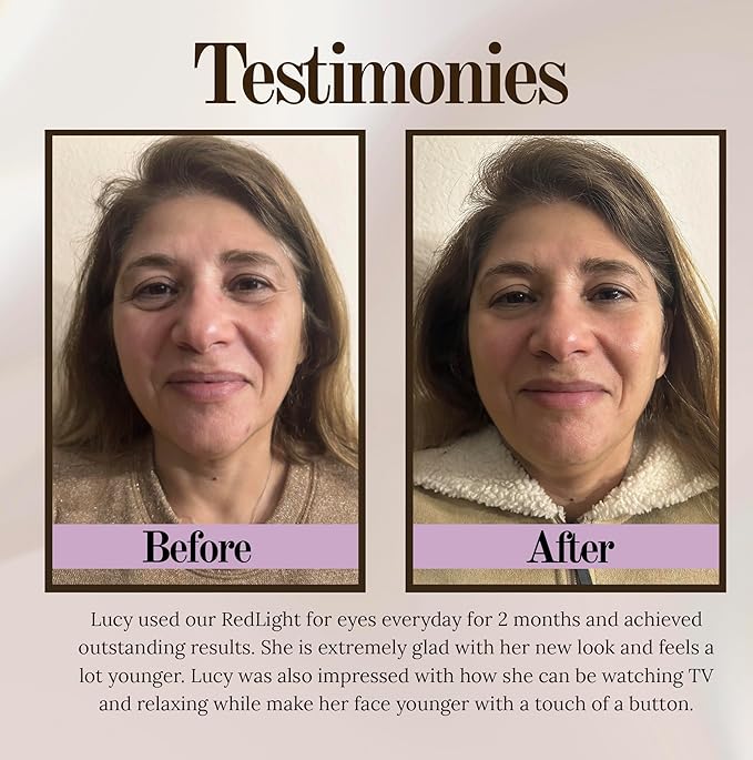 Red Light Therapy Gadget Patch for Dark Circles, Eye Bags, Eye Wrinkles. Red Light Eye Mask. Dermatology Eye Mask. Anti-Aging Eyes. Eye Pods. Eye Patches for Bags.