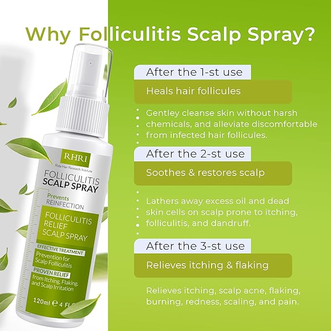 Folliculitis Scalp Spray | Dandruff Treatment for Dandruff, Psoriasis & Folliculitis | Antifungal & Anti Dandruff Itchy Scalp Treatment Formula Spray for Dry and Irritated Scalp