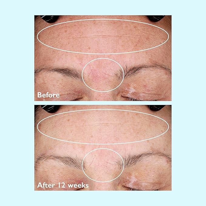 Restoring Night Cream with Vibransea Complex, 1.7oz