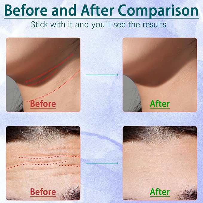 Face and Neck Tool, 7 in 1 Electric Facial Device for Wrinkle Removal at Home Daily Use (White)