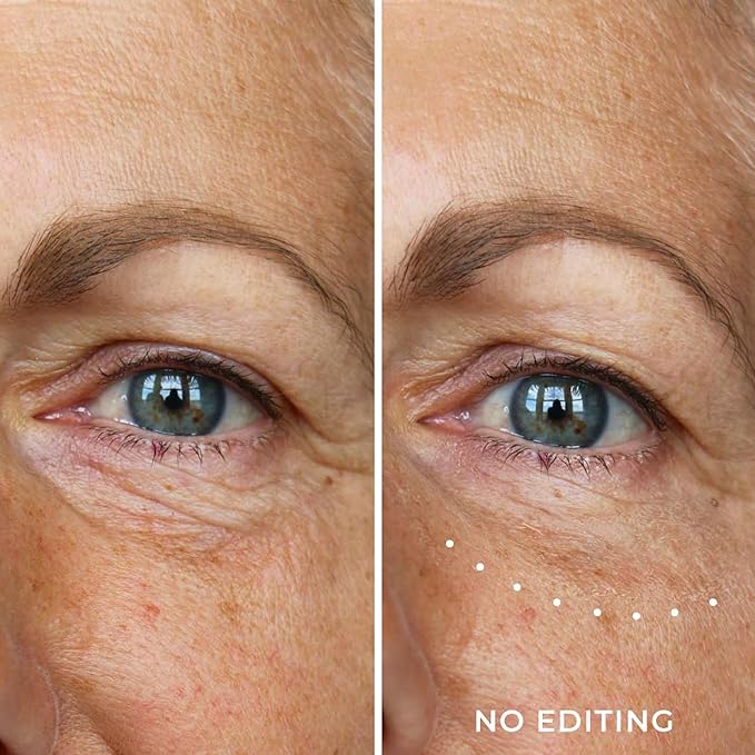 Wunderlift 60 Second Wrinkle Reducer & Wunderlift Night Retinol Eye Cream, Contains Retinol, Hyaluronic Acid