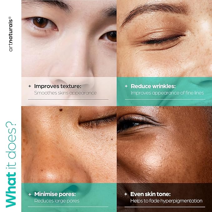 Artnaturals Niacinamide Face Serum, 10% Active Niacinamide with 1% Zinc PCA & Vitamin B3 - Hyaluronic Acid, Pore Reducer, Mineral Blemish Protection, 1 oz