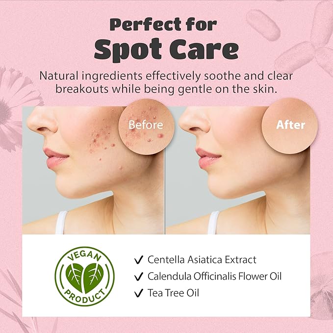 lattcare Calendula Nose Pore Strips 6Ct + Dalgona Skin Shield Patches 15Ct | Duo Pack | Blackheads Remover | Blackheads Remover | Pimple Patches | Hydrocolloid Acne Patches | 2 Items of 1 Pack