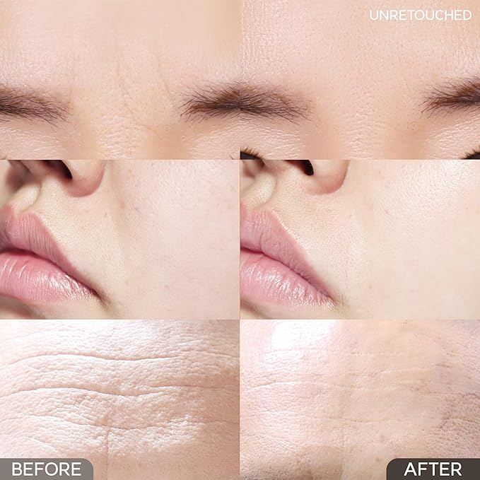 Wrinkle Repair Patches for Frown Lines Eleven Lines - Between the Eyes Wrinkle Patches Non invasive Wrinkle Smoothers for Face Wrinkles - Face Wrinkle Pad- Korea Beauty Face Treatment